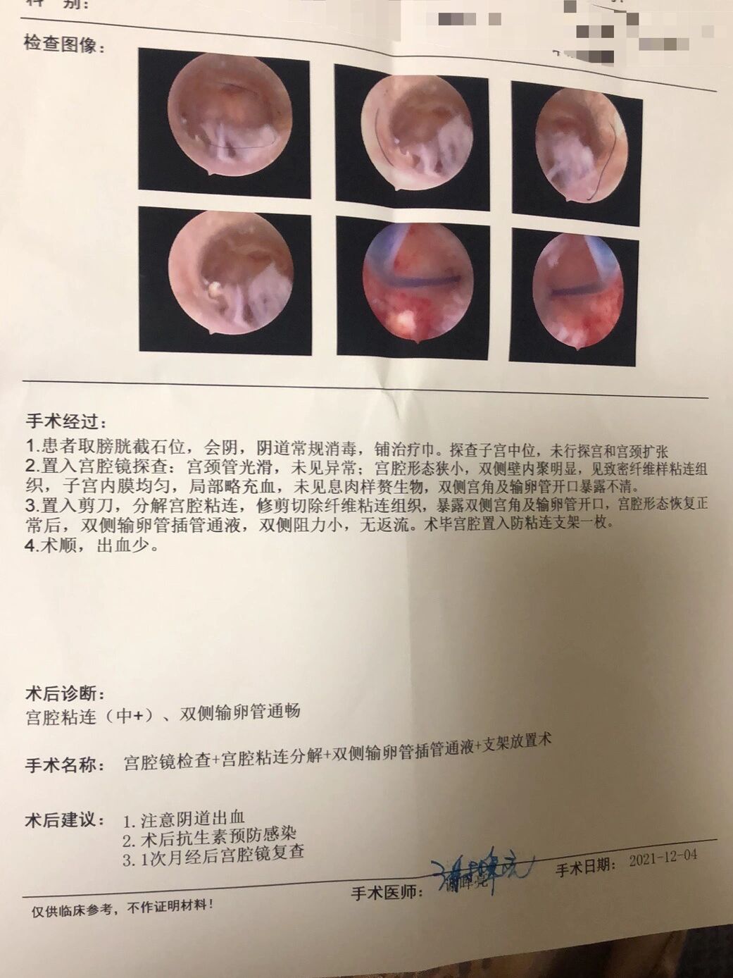 宫腔粘连(2) 继11月无锡的第一次手术,让我感觉真的找对医生可以少