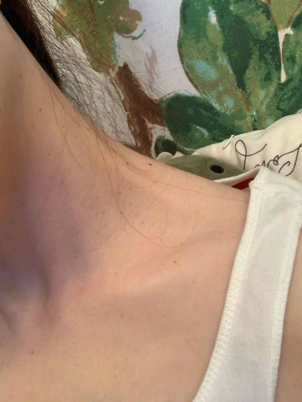 脖子上好多像痣一样的小黑点 到底是痣还是疣呀 愁人 有集美懂吗