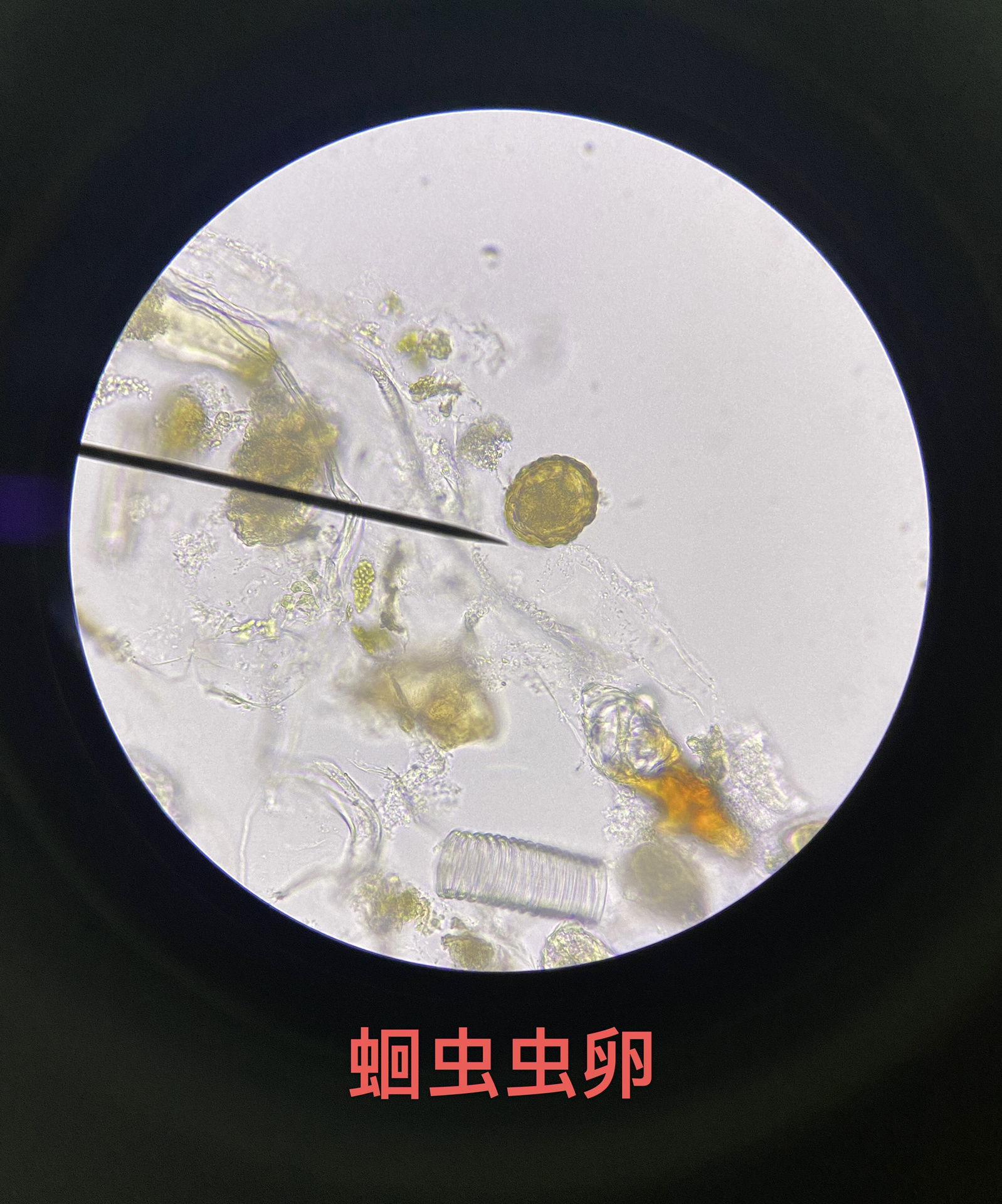 显微镜下的寄生虫卵 你认识几个? 94