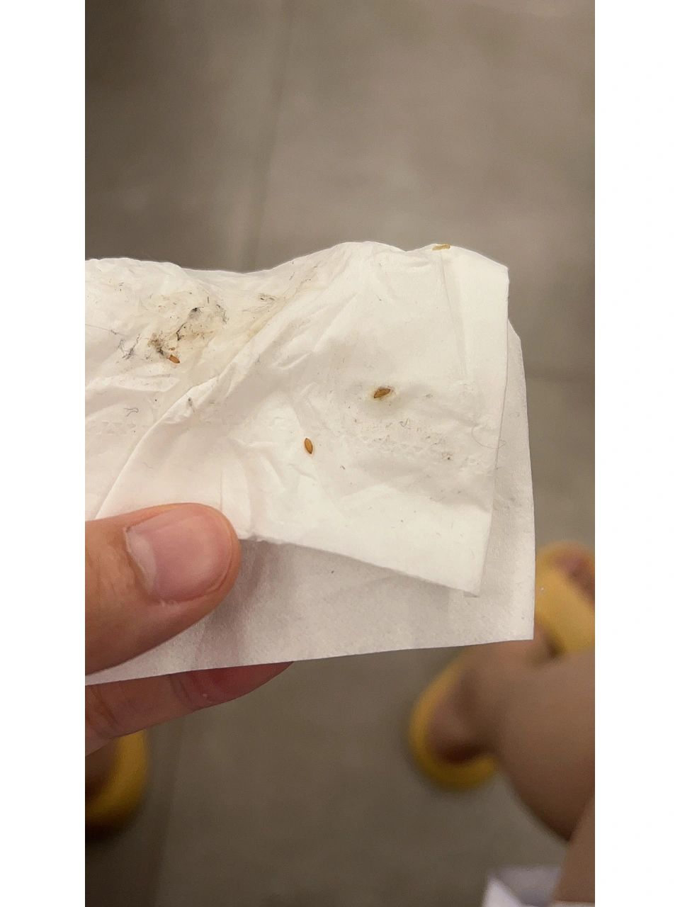 墙边出现这种虫卵,好怕啊 ,墙边出现这种虫卵,好怕啊,不知道是什么虫