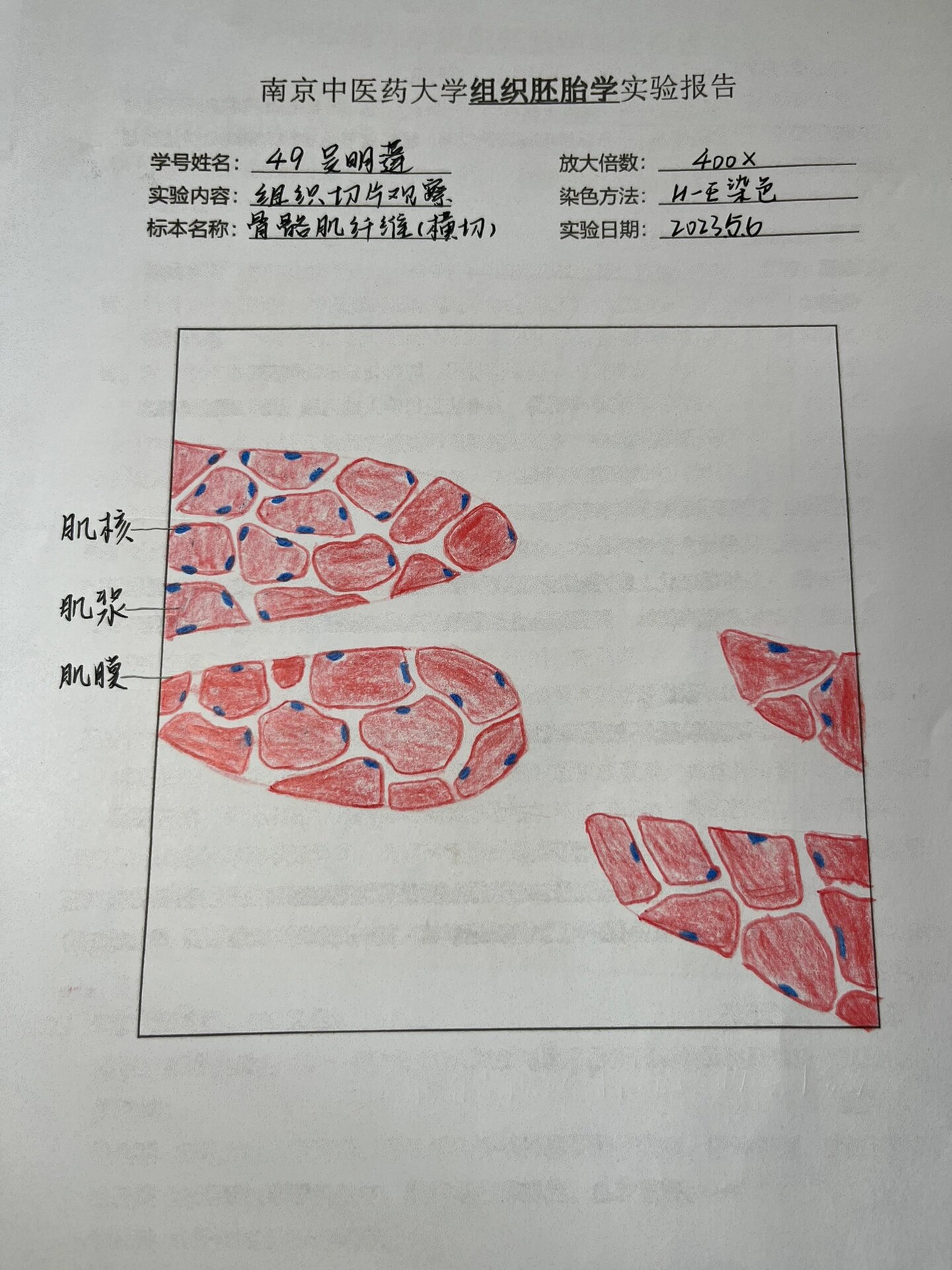 变移上皮40倍手绘图图片