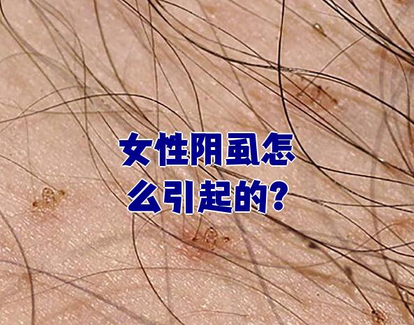女性阴虱怎么引起的?