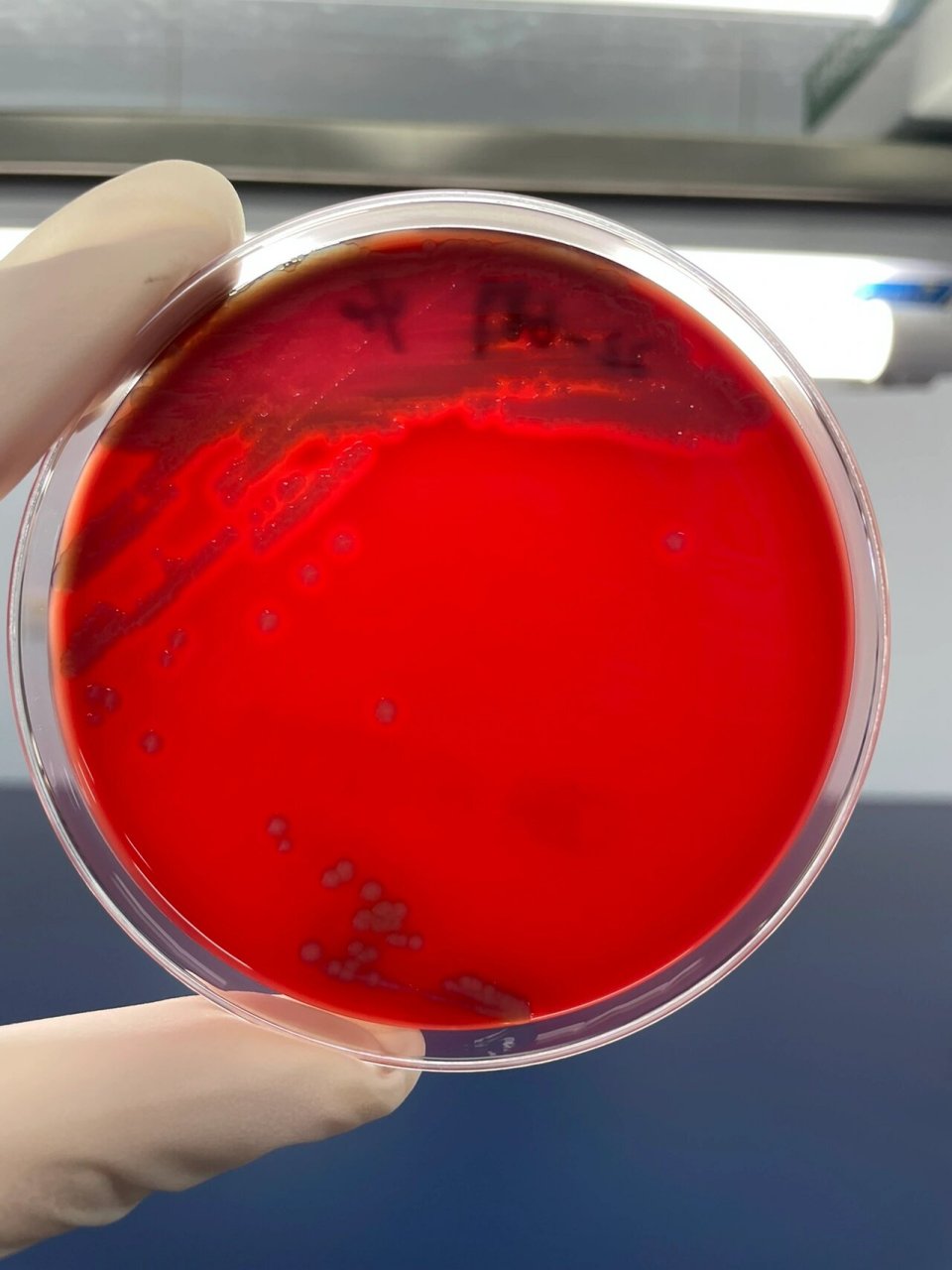 每日一菌-14 来源: 分离自粪便中的非o1群非o139群霍乱弧菌 图1:tcbs