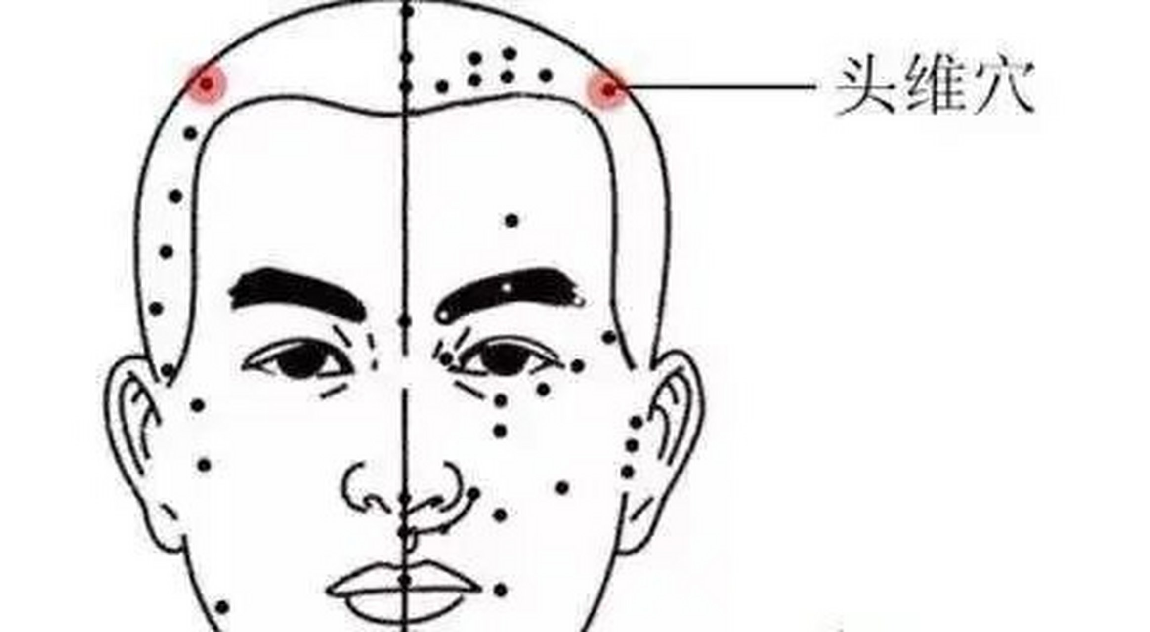 头部太阴的准确位置图图片