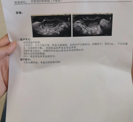 阴超是检查子宫,输卵管和卵巢的常用方法,能发现这些部位有没有长异常