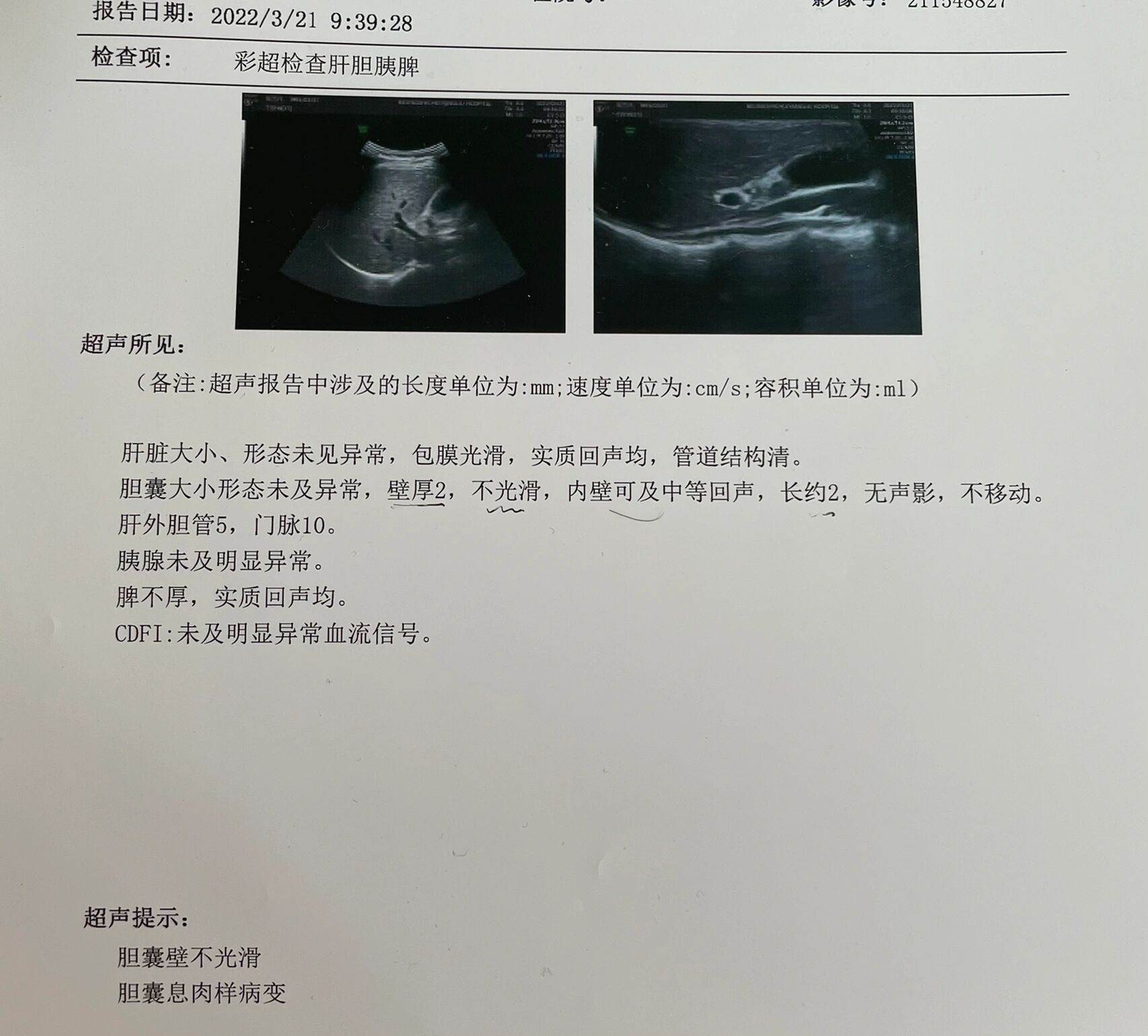 记录胆囊炎 胆汁淤积 胆囊息肉的发现与治疗