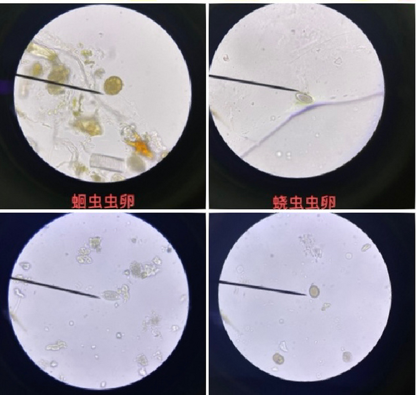 显微镜下的寄生虫卵 你认识几个?  94 大家在工作中遇到过几个?