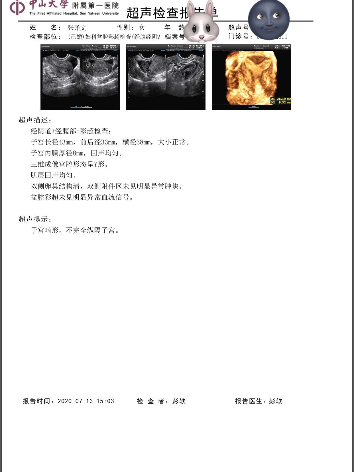 记录下我备孕到怀孕的过程,不完全子宫纵隔 秉承着优生优育的原则,去