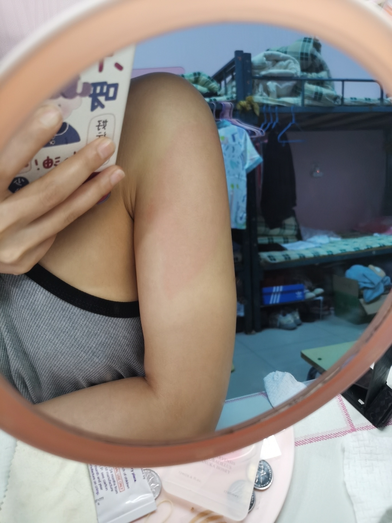 第二针新冠疫苗后过敏