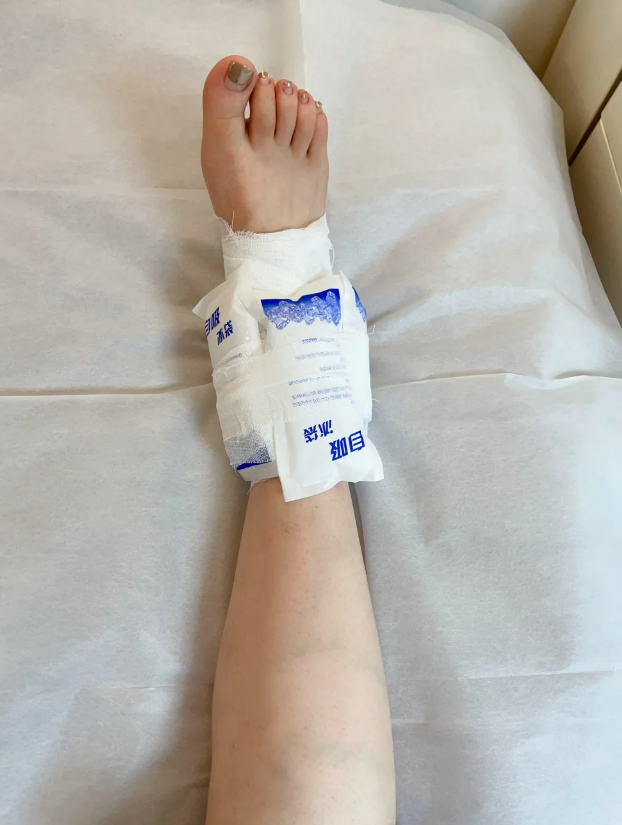 脚踝扭伤后肿胀多久能好,主要看损伤程度