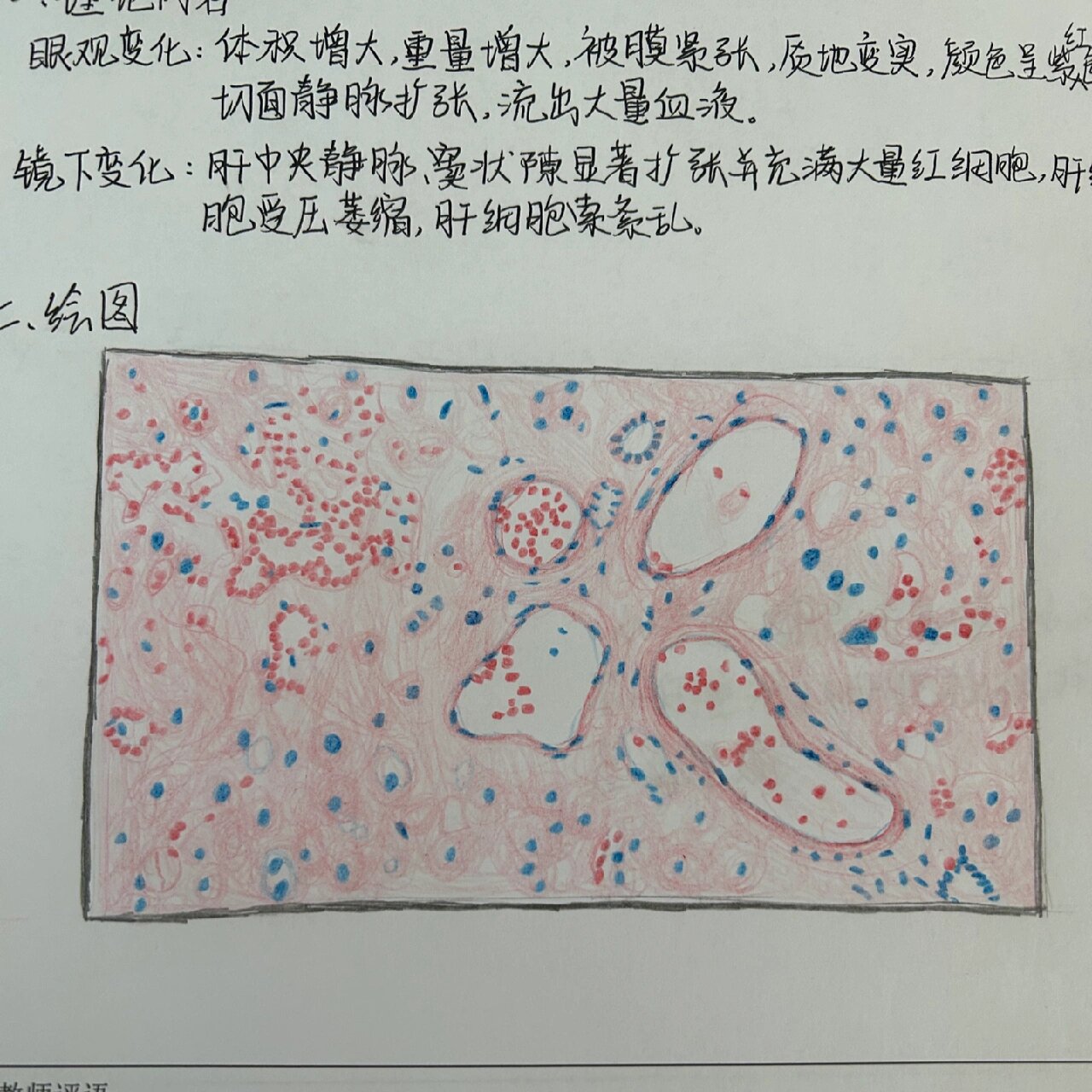 肝血窦的绘图图片