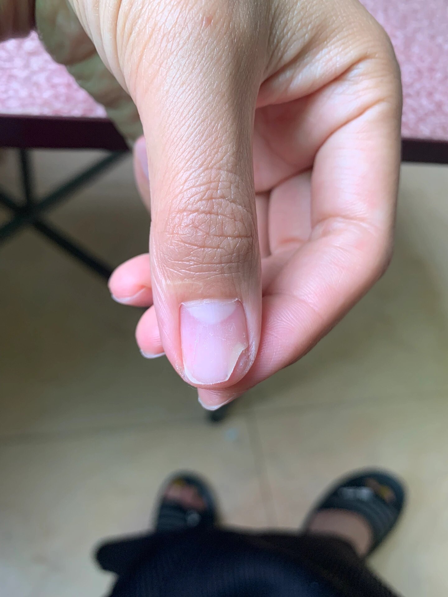 指甲空了就剪掉一直长出来就好了