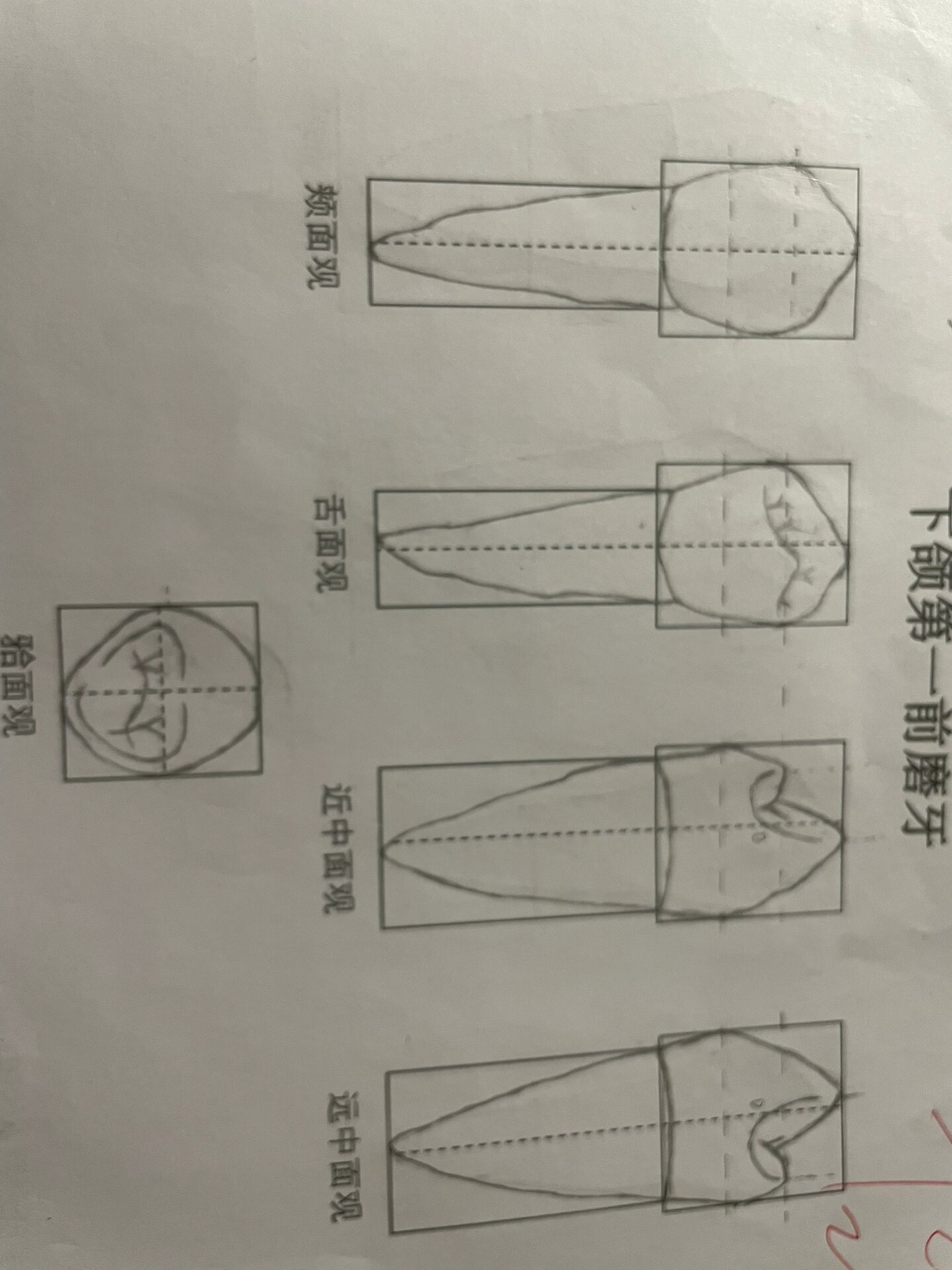 下颌第一磨牙绘制图图片