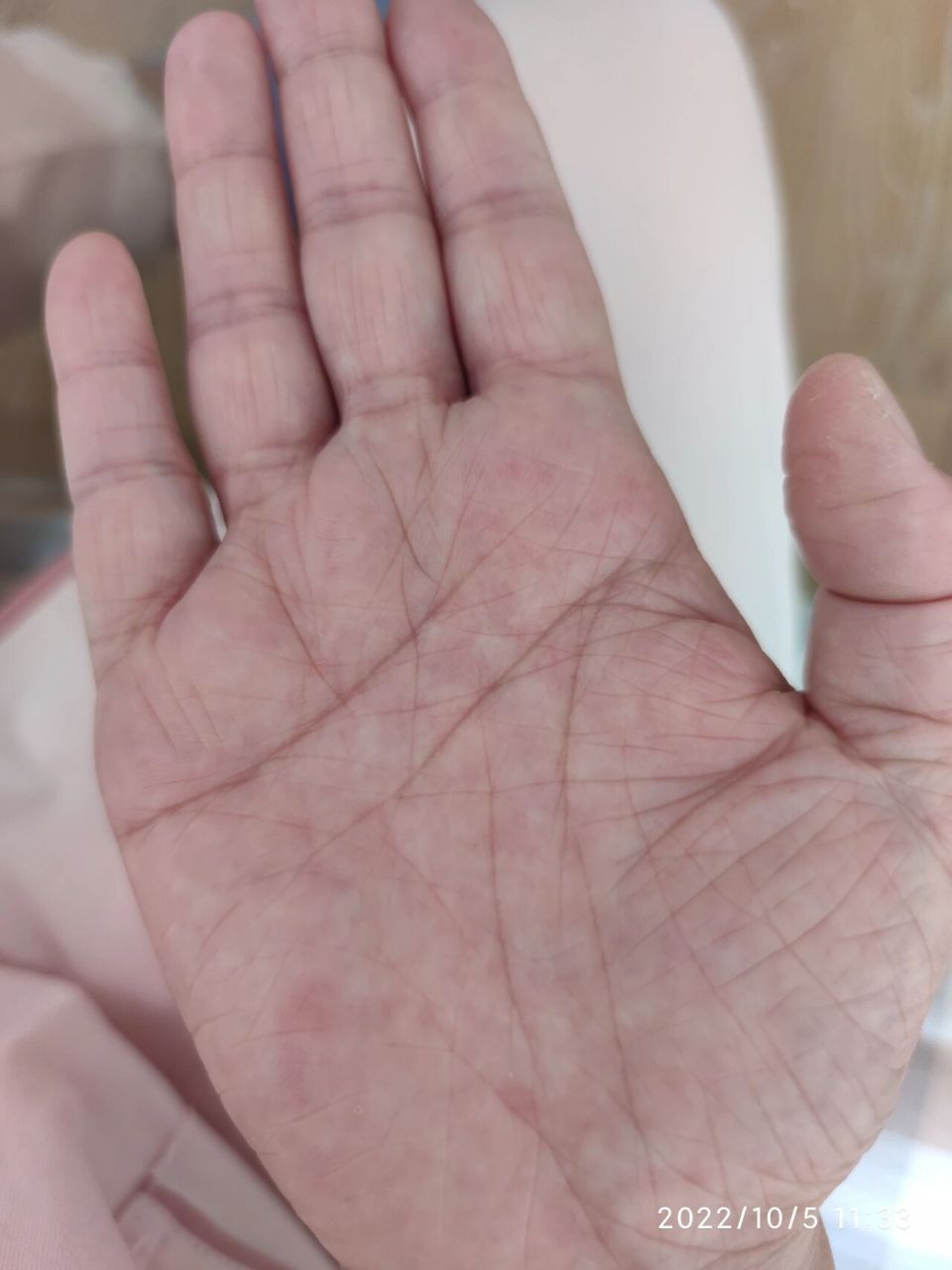 生命线三条分叉,又断开,找遍全网也没解读 有没有懂得帮忙看看,三条