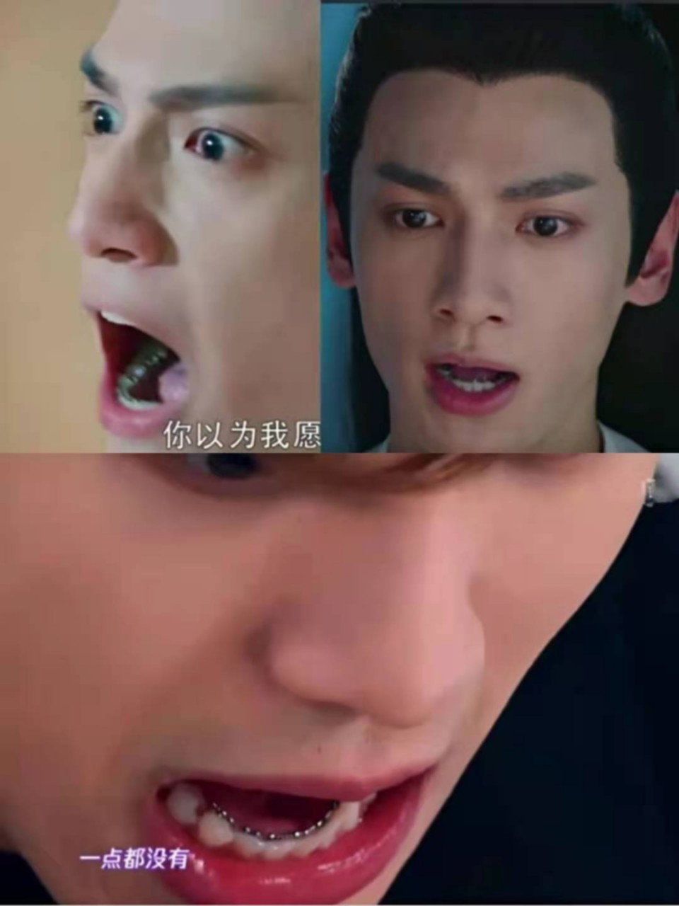 你发现没,这些男明星都带了隐形牙套[ 很多明星出道初期都是一口奇形