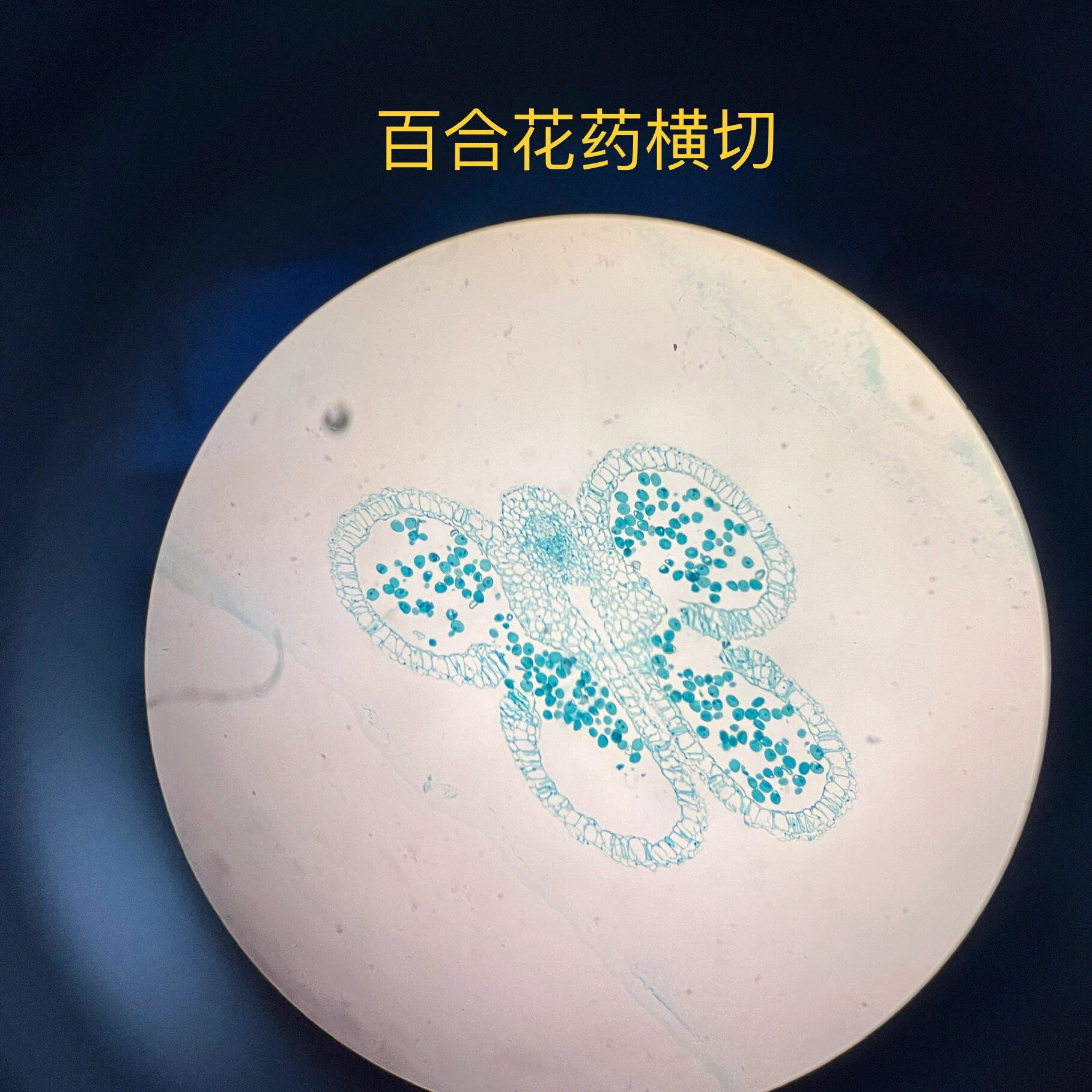 百合花药横切结构简图图片