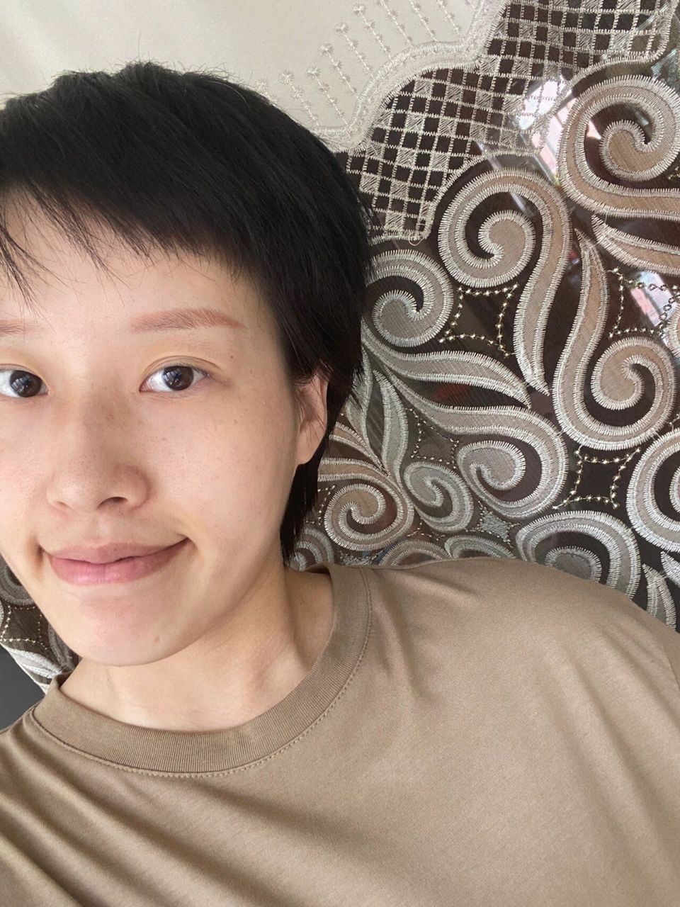 光头蓄发六个月整🌼 光头蓄发六个月啦 原相机拍摄,头发也未修剪过