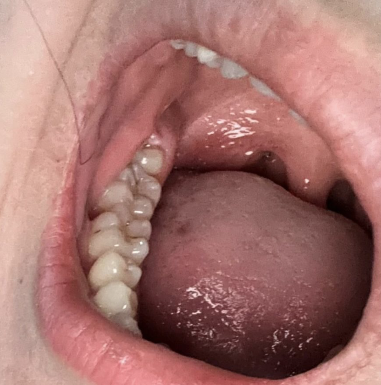 为什么医生不建议做脱敏治疗的简单介绍