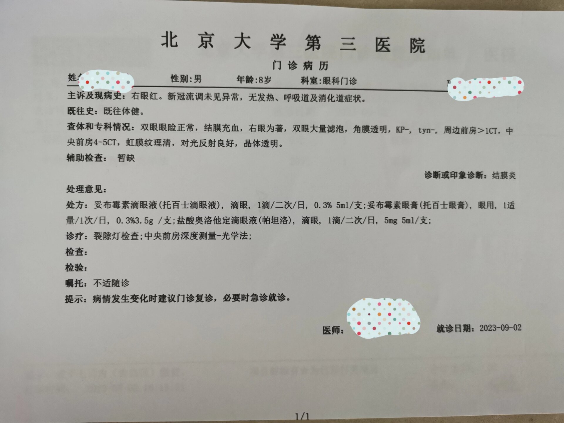 小朋友过敏引起结膜炎,变成红眼睛了… 小朋友右眼红了, 早上起床还有