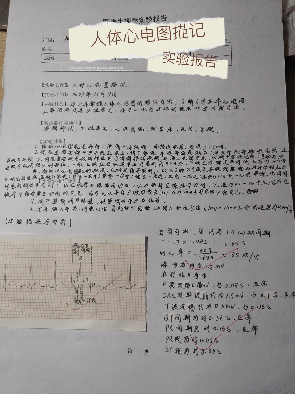 心电图测量实验报告图片