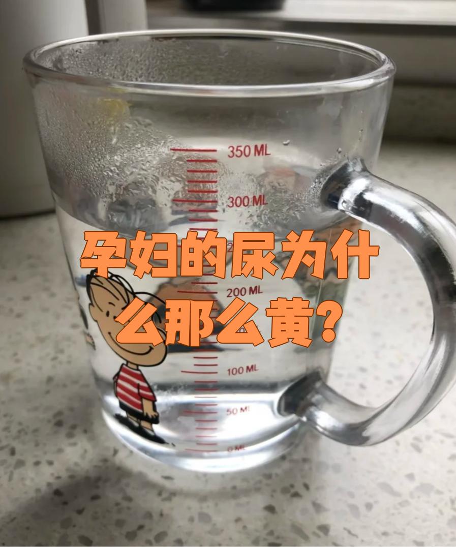 尿为什么是黄的