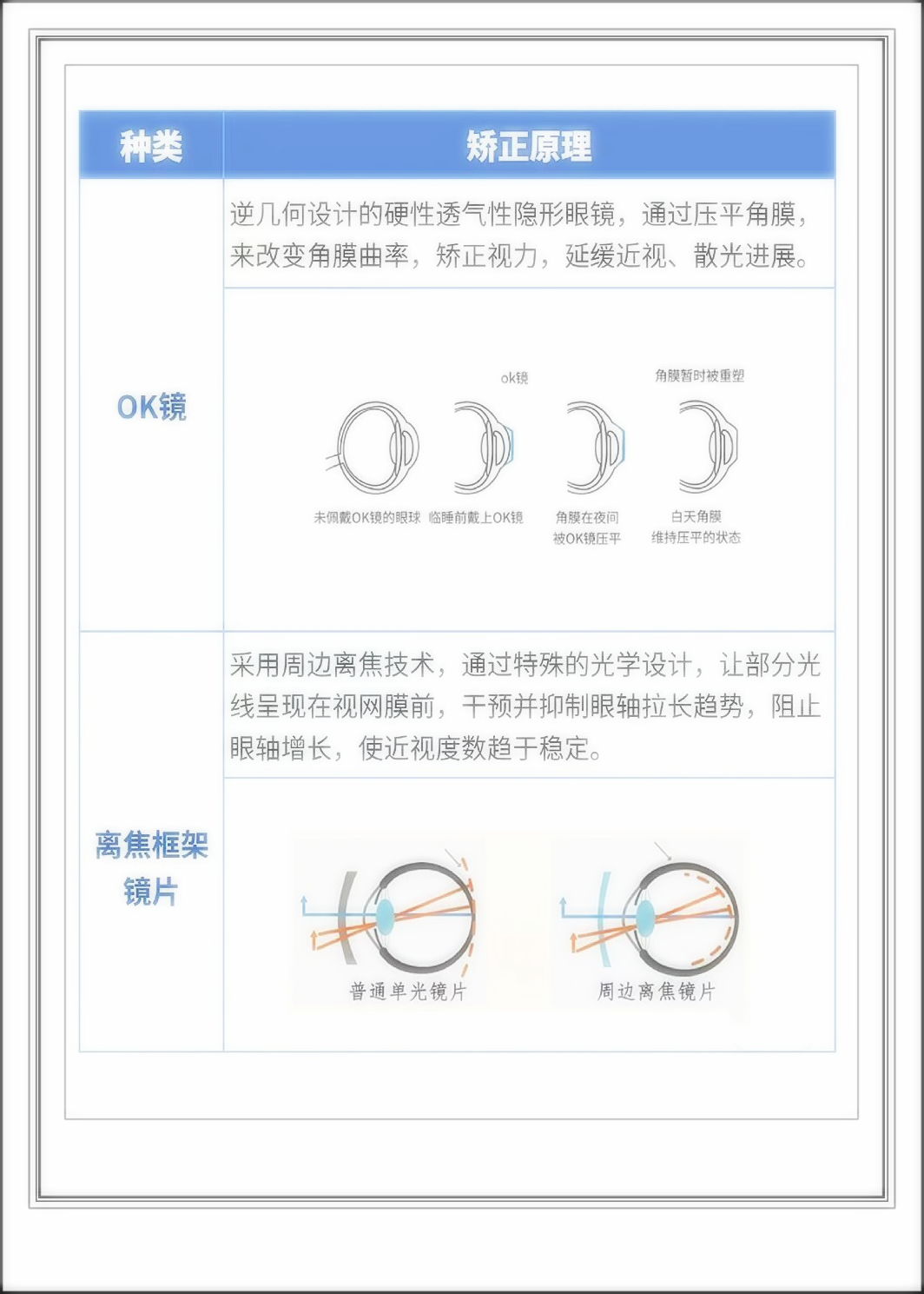 ok镜是隐形眼镜吗图片