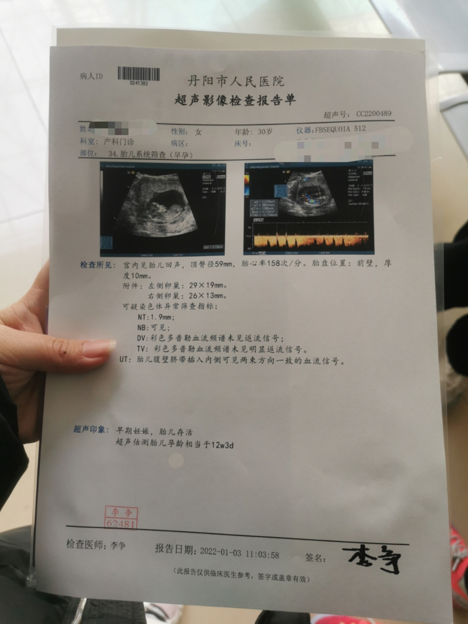 孕囊位于宫腔下段,nt检查都好的!传好运!