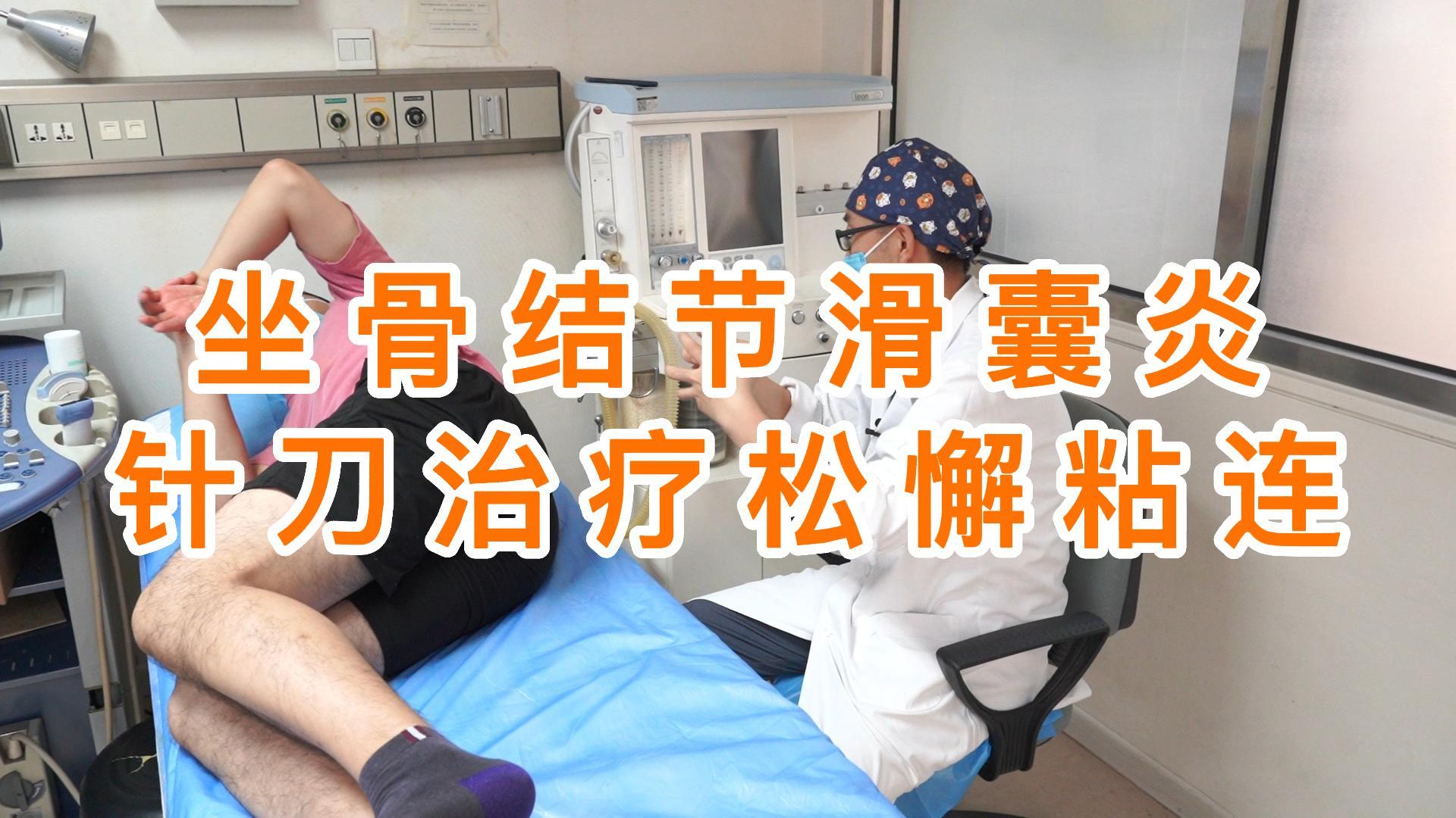 一个坐骨结节滑囊炎的患者针刀治疗后感觉有好转了
