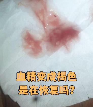 血精变成褐色通常不代表病情在好转