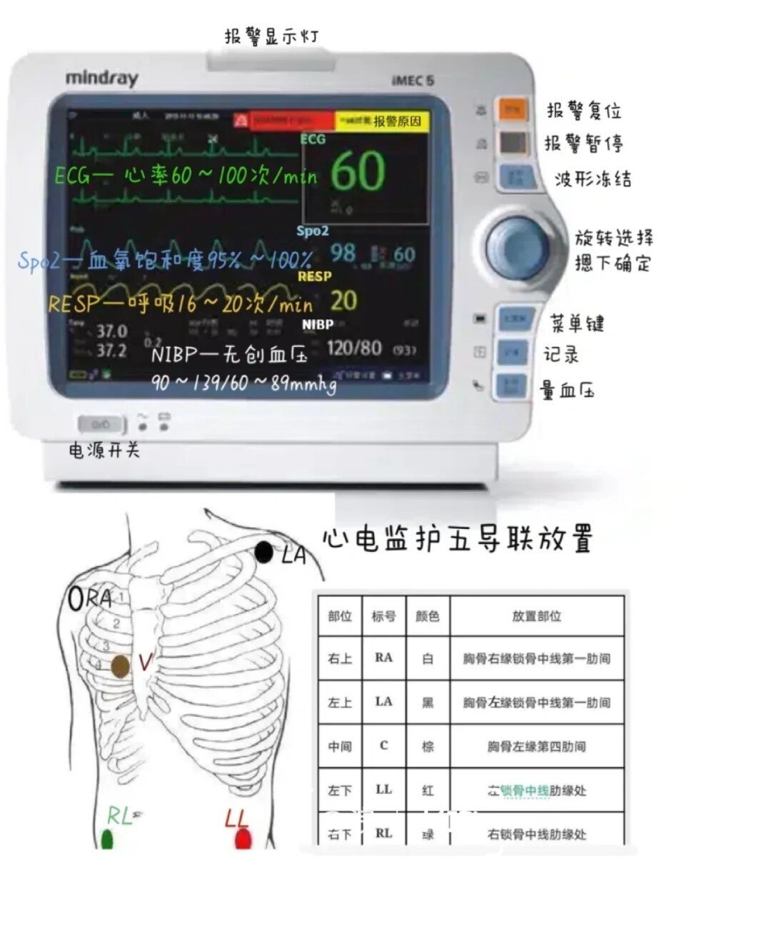 心电监护仪说明书 图图片