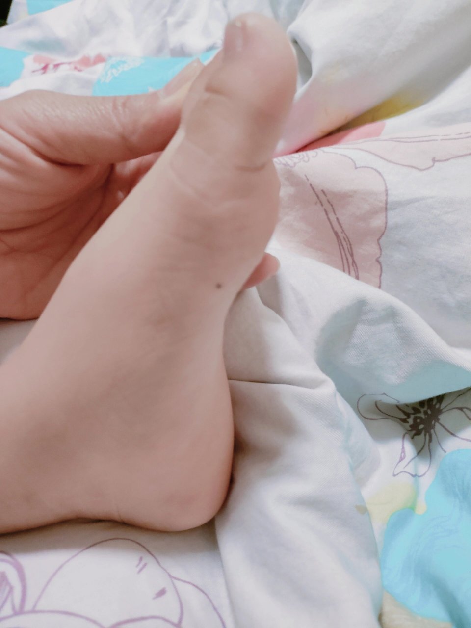 四岁宝宝脚大拇指一侧有痣需要去掉吗 看小红书上面好多都说需要切掉