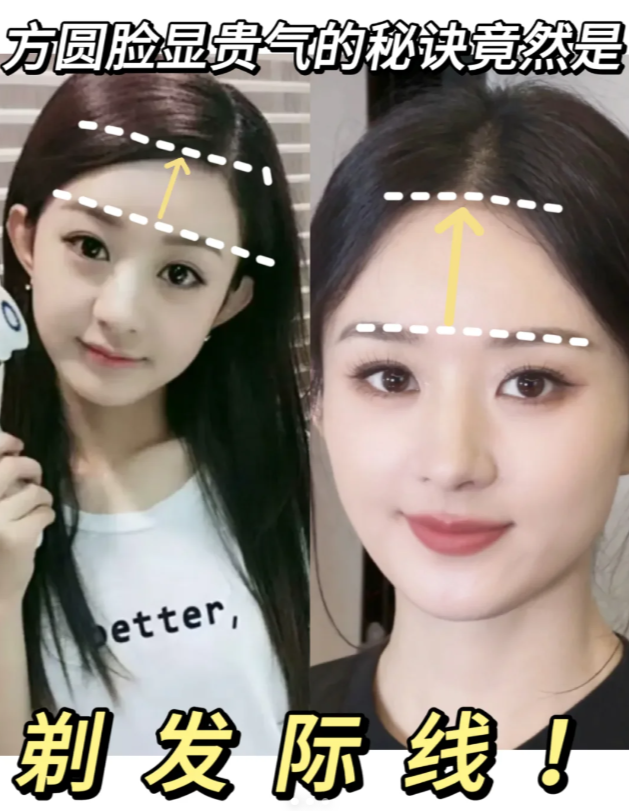 赵丽颖早期发际线低比较,而且前面小碎发很多,再加上早期的"婴儿肥"让