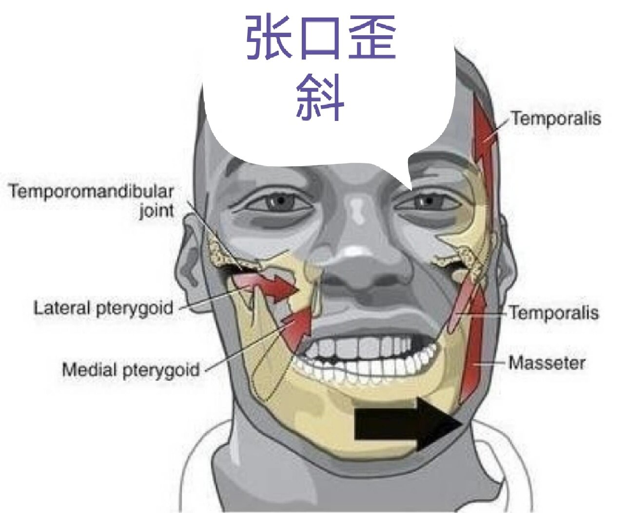 颞颌关节结节图片