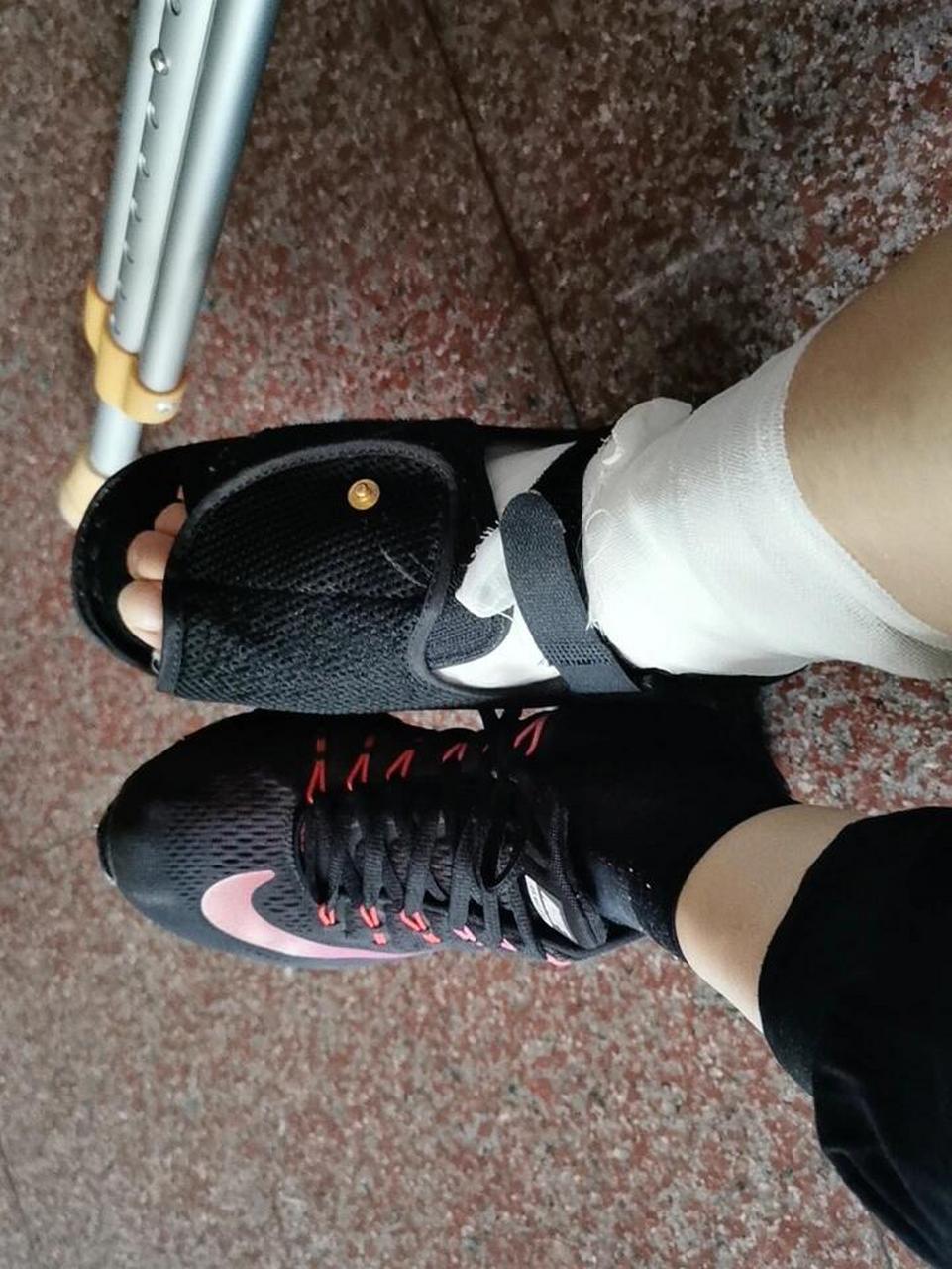被医生痛批的石膏鞋 上周去骨科医生那里换药,门口有个同样右脚踝骨折