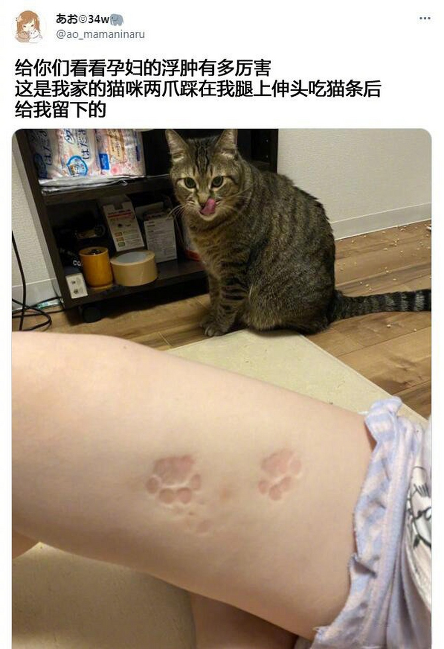 原来孕妇浮肿后能印猫爪爪[喵喵]   #幽默