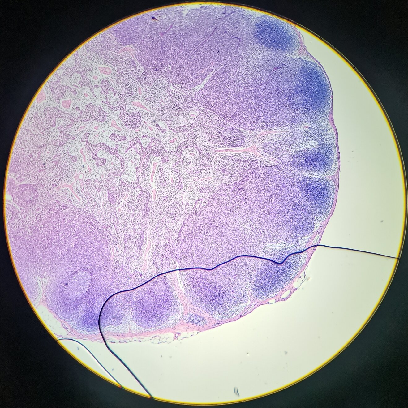 组胚绘图-淋巴结 p5 皮质 p6-8 髓质