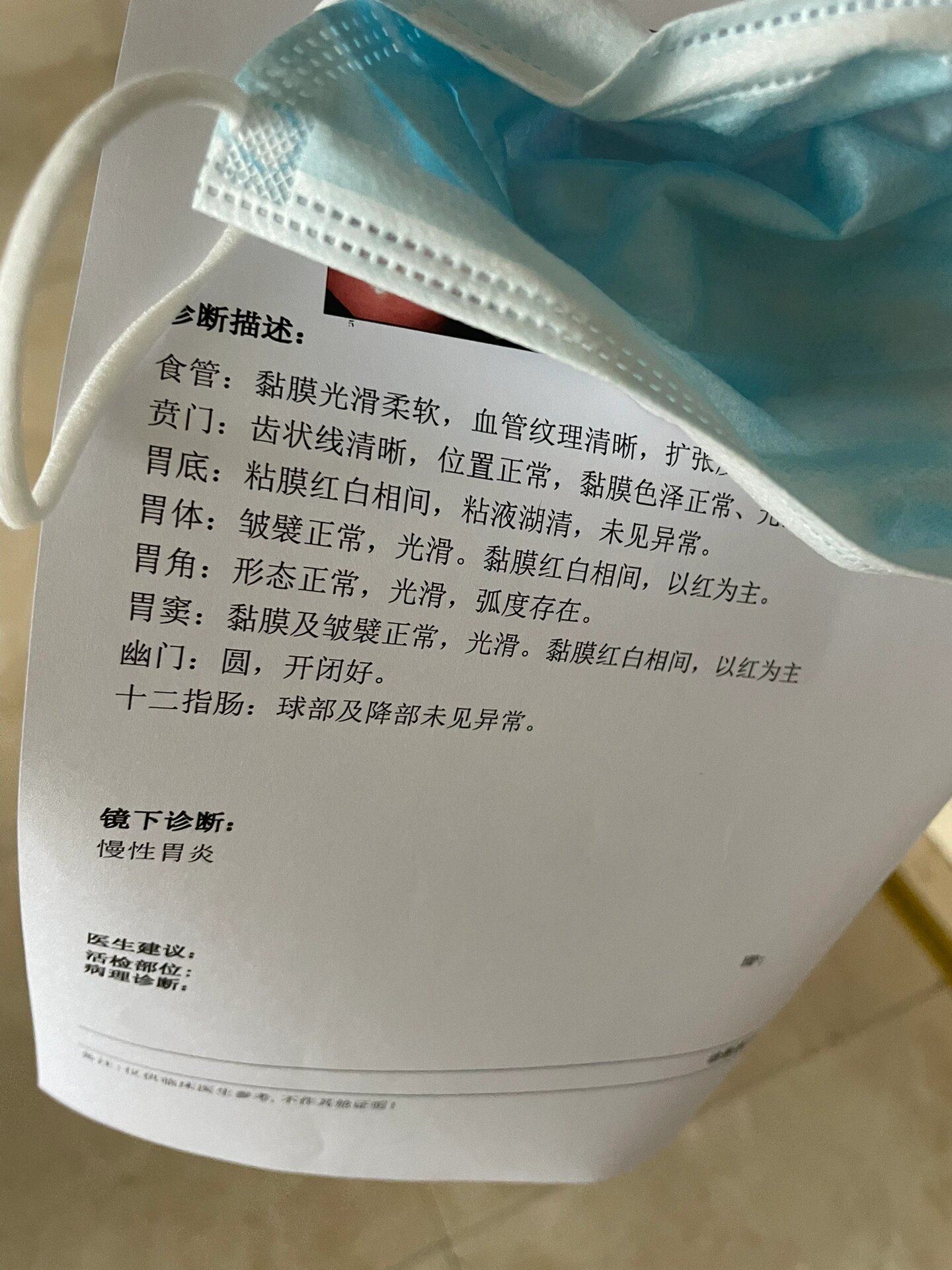胃反复疼了一个星期,昨天预约了胃镜 刚做完,过程很痛苦,一边流泪一边