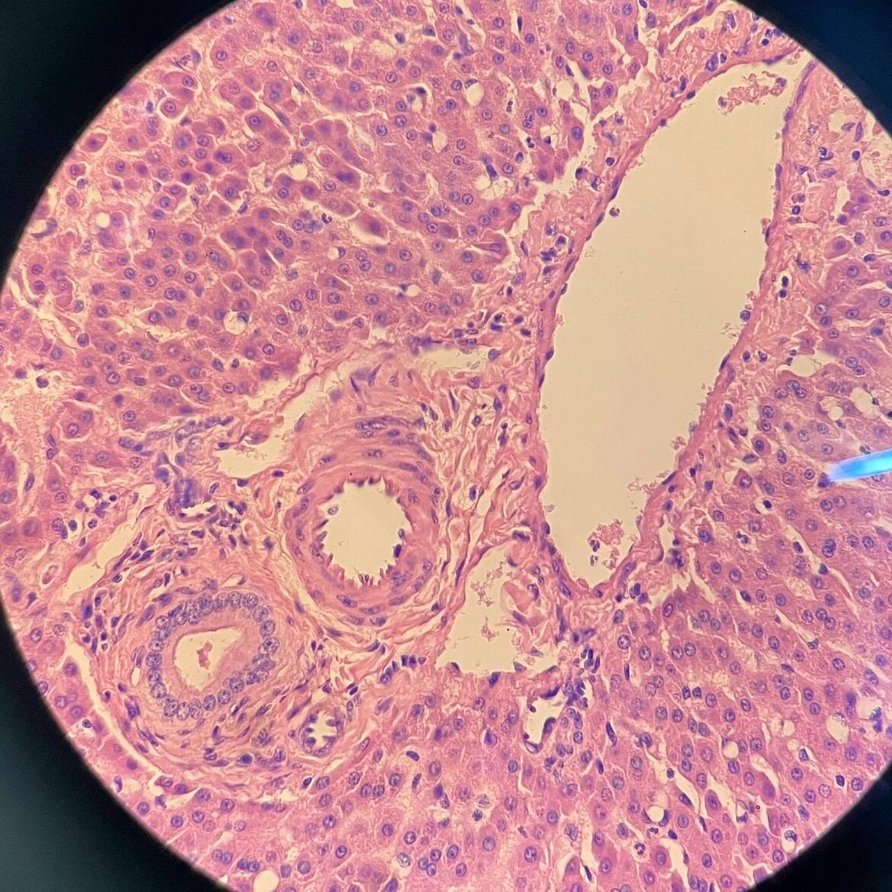组胚绘图10-肝(人) 肝小叶和门管区 dbq门管区画得有点太大导致中央