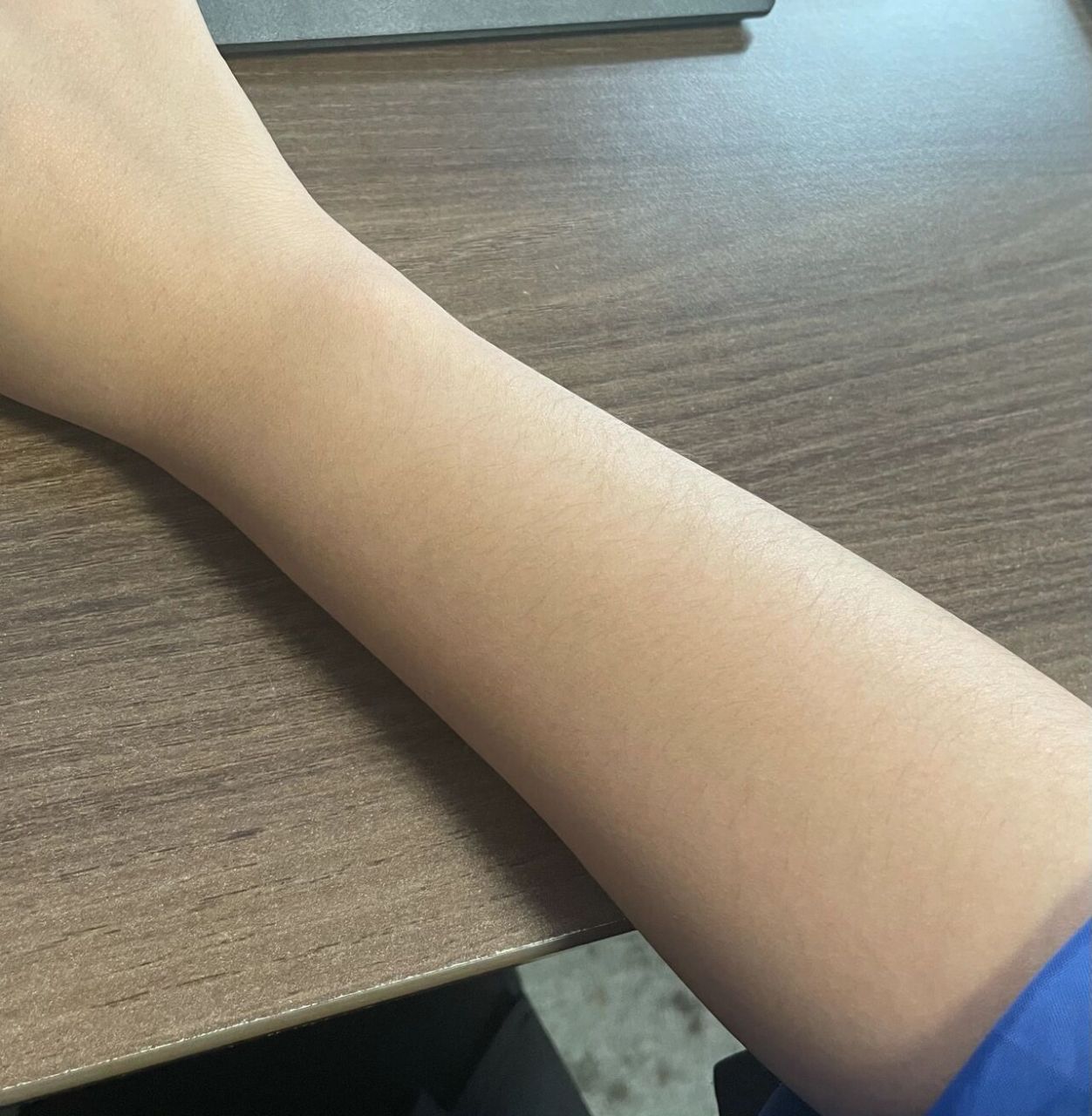 救命98汗毛突然变长了怎么办 前几天无聊的时候突然发现胳膊上汗毛