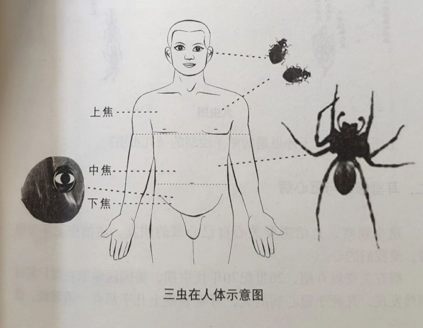 欲望越多,无形的寄生虫越多    三尸虫 三尸虫是生活在我们人体的无