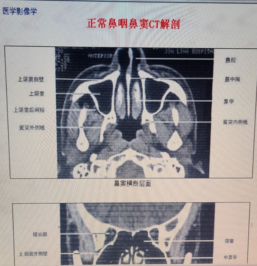 这是最常用的方法,可以直接观察鼻腔内部情况