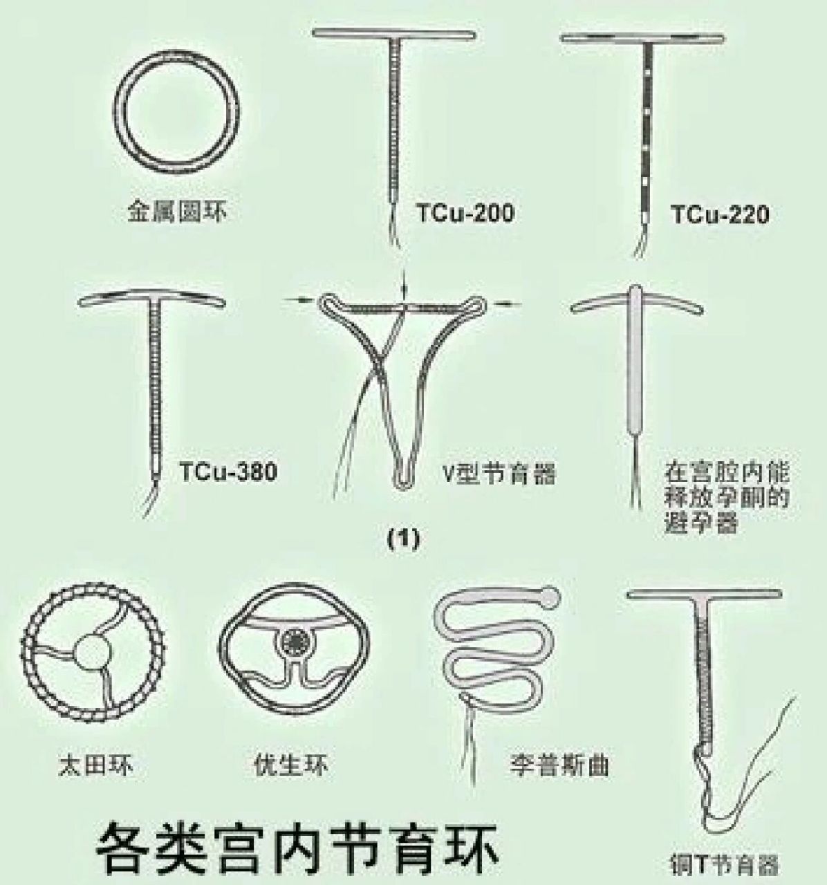 节育环一定要取出来吗?