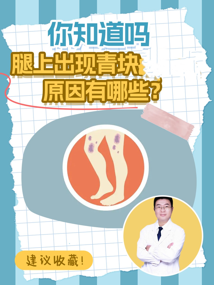 你知道吗 在日常生活中,有时会不经意间发现腿上出现青块,这不禁让人
