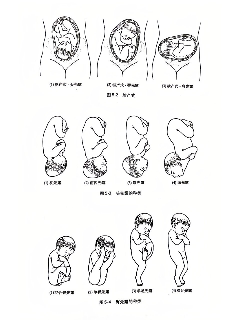 loa,请继续保持79 快32周 连续两次产检显示loa胎位,适合顺产的胎位