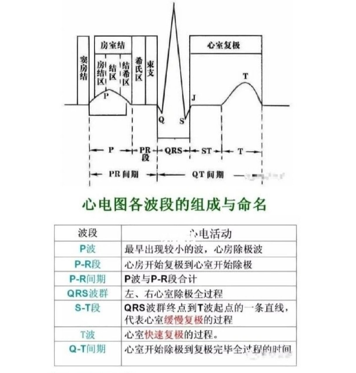 正常心室除极顺序图解图片