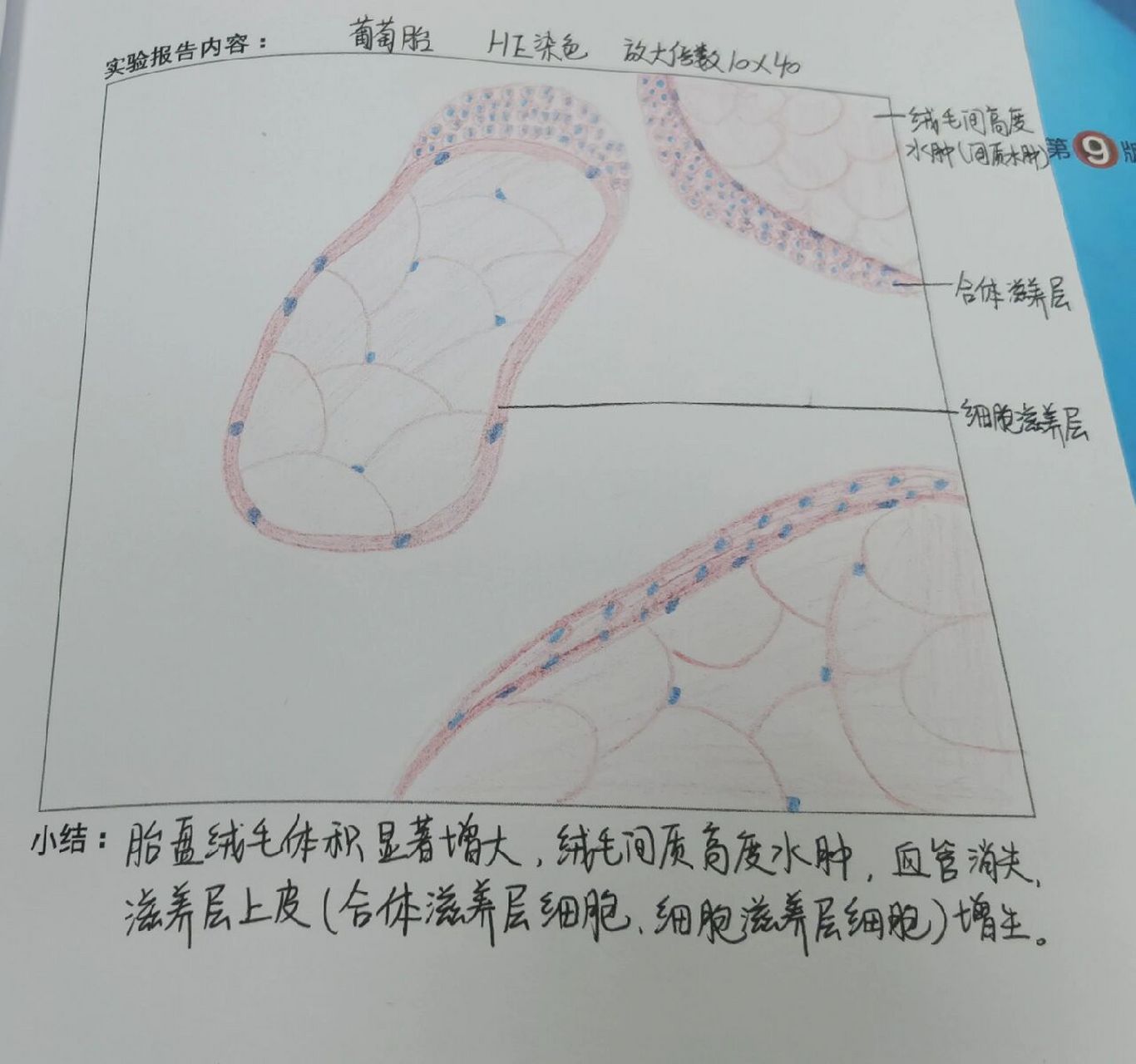 「葡萄胎」绘图红蓝铅笔 随缘更新～ 形态学绘图作业红蓝铅笔,仅供