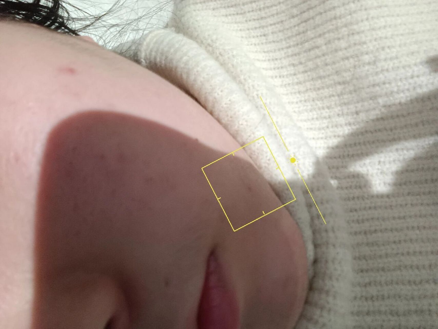 不痛不痒,但是你摸上去很明显的鼓包,可能我肉多,看起来不太明显.