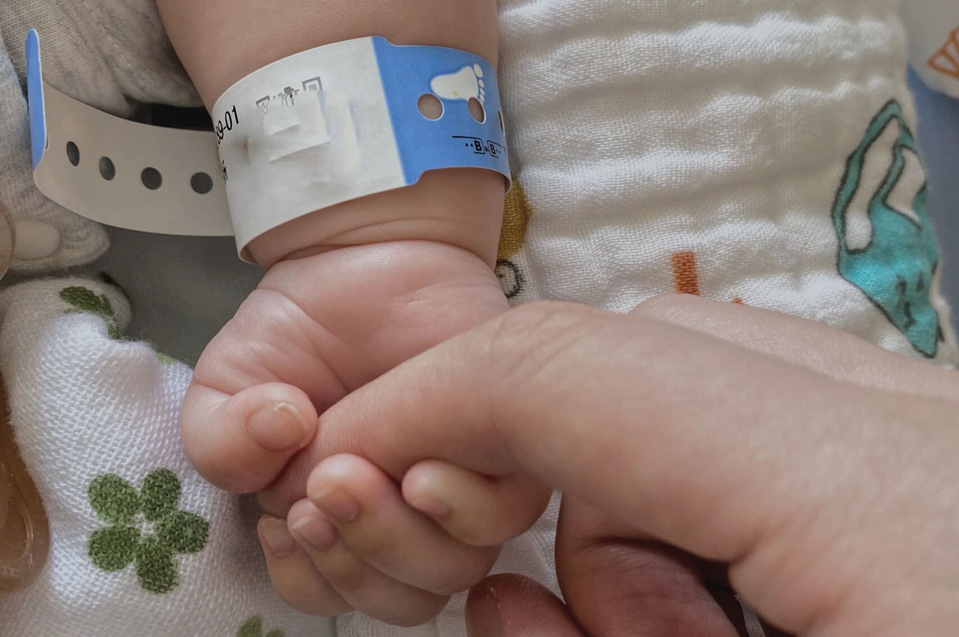 新生儿腹股沟疝气|2月龄宝宝手术 下 因为弟弟太小,才两个月,关于是否