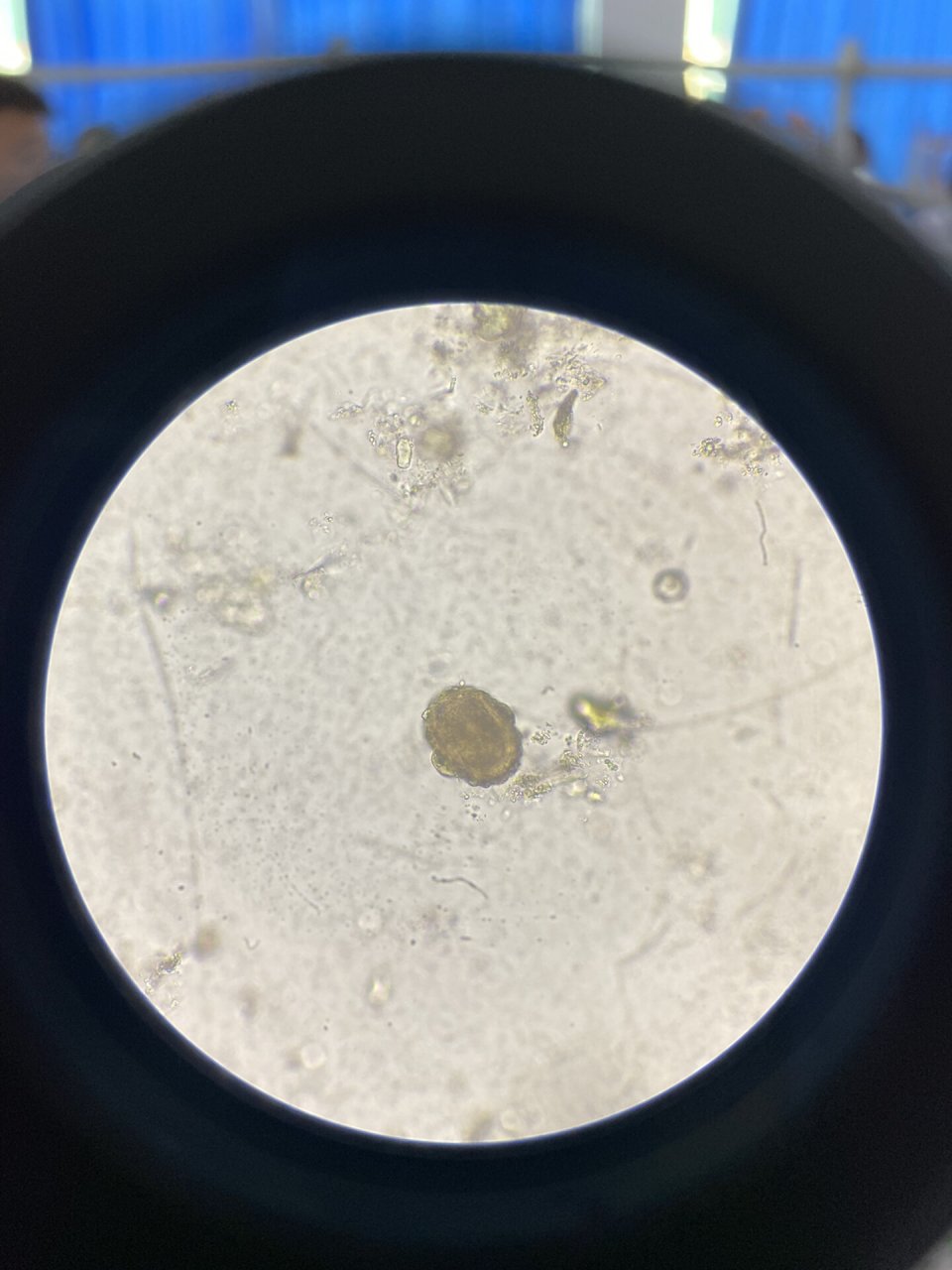 受精蛔虫卵与未受精蛔虫卵区别
