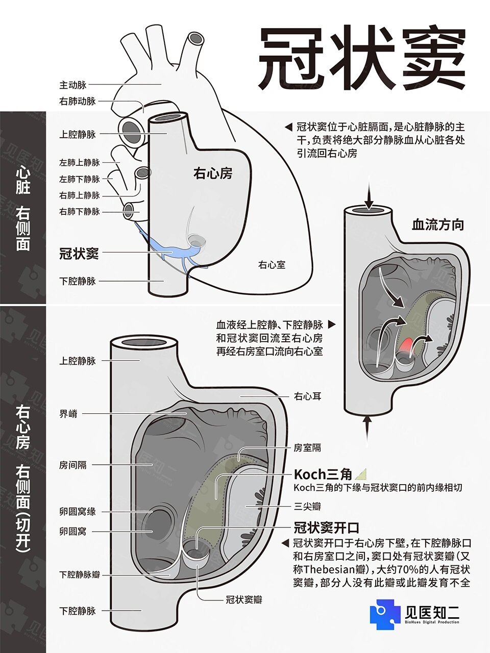 冠状静脉窦口解剖图图片